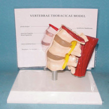 Human Lumbar Vertebra Muscle Medical Anatomy Model (R040109)